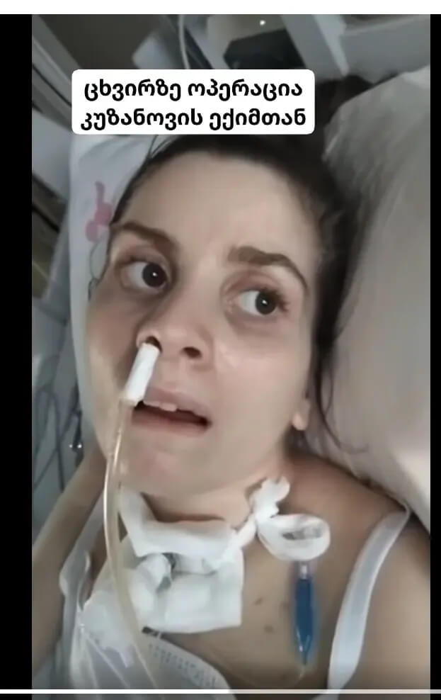 კუზანოვის კლინიკასთან დაკავშირებული ექიმის ოპერაციის შემდეგ 21 წლის პაციენტი მძიმე მდგომარეობაში &ndash; ადვოკატი ოჯახის ბრალდებებს აცხადებს